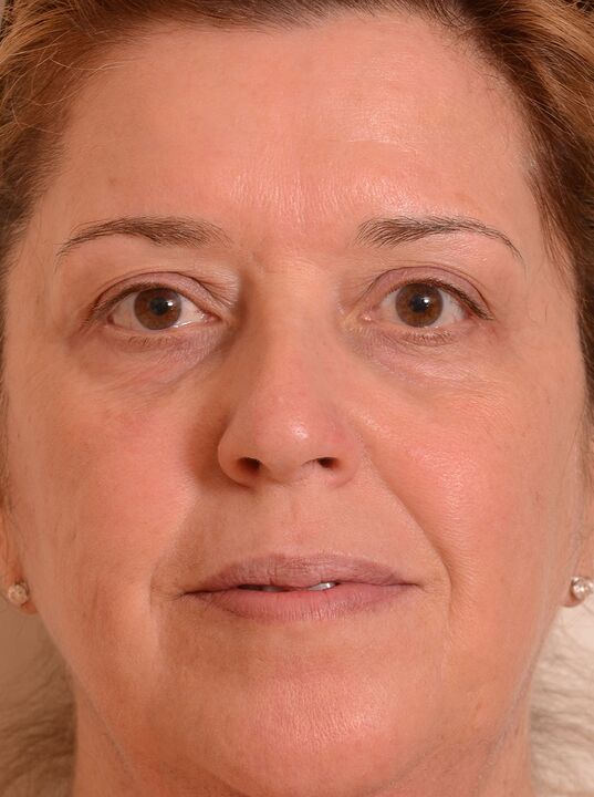 Obraz sem pomladil s kremo Eudalie