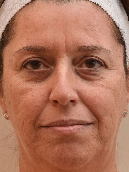 Tako sem pogledal, preden sem uporabil kremo Eudalie