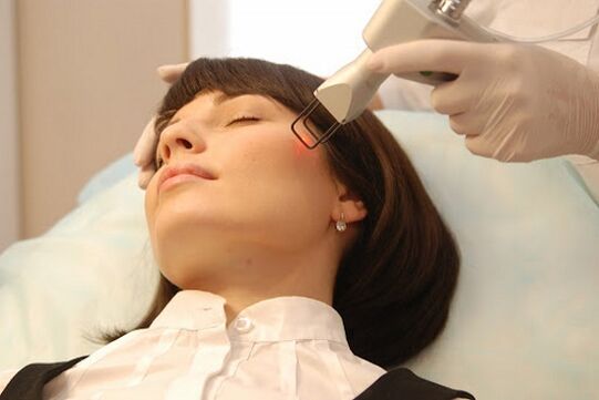 Ultrazvočni lifting